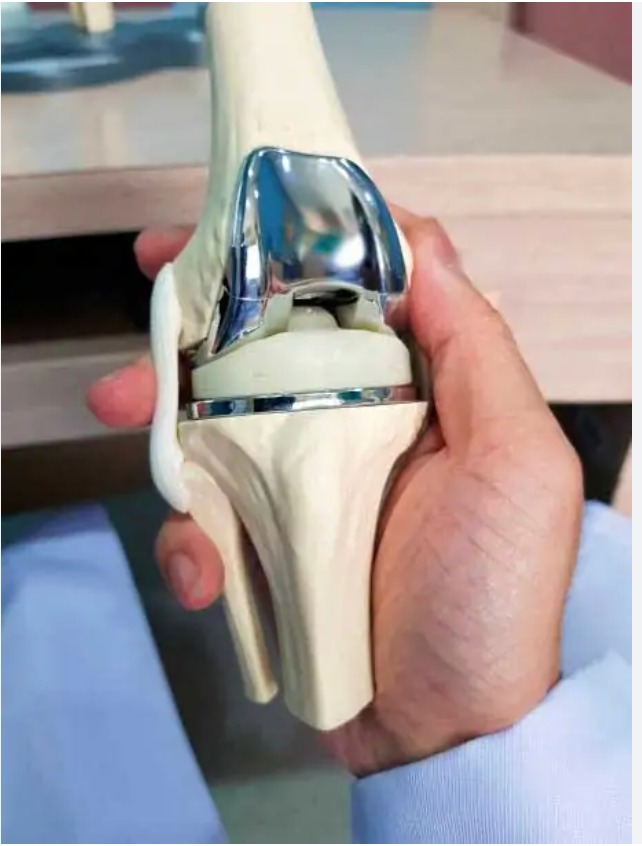 Cirugía de Reemplazo de Rodilla en Interlomas - Ortopedia GAVE